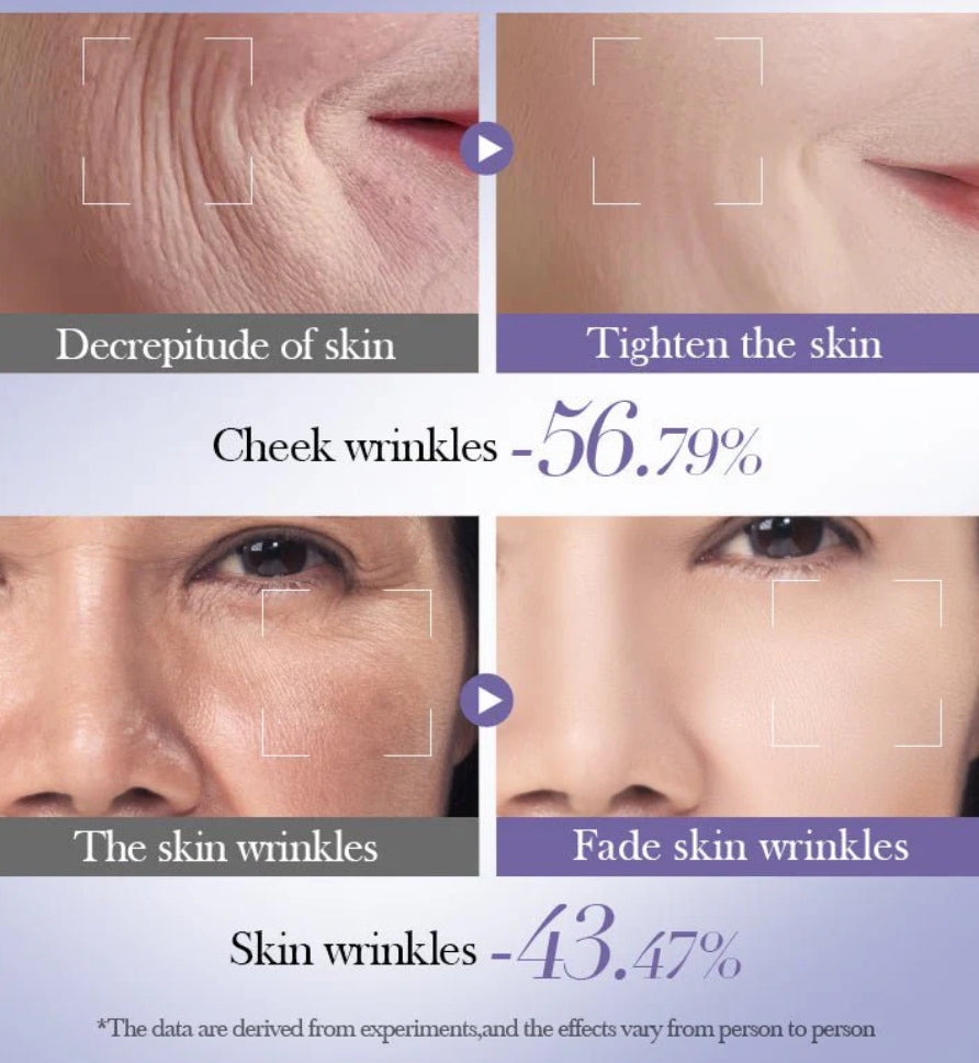 Bioaqua - Retinol Skin Set (Original)